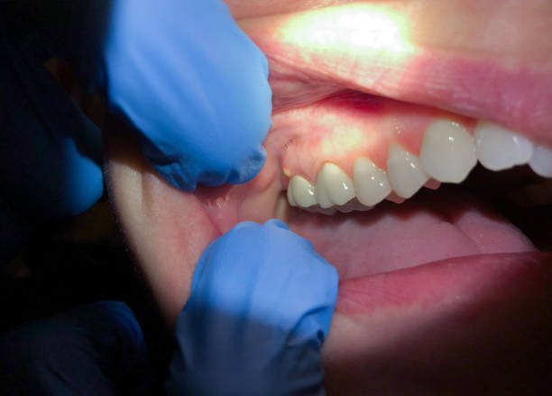 Best Emergency Dental Clinic in NH