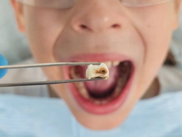 Best Emergency Treatment for Oral Infections in Dover, NH